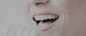 Invisalign