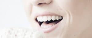 Invisalign