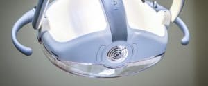 Frenulo e Diastema