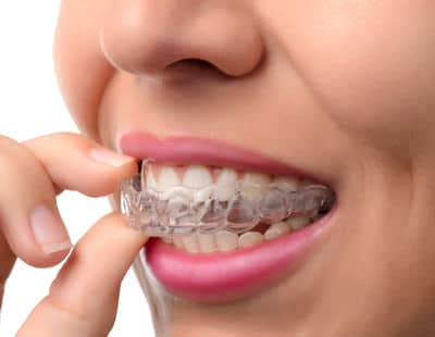 Invisalign