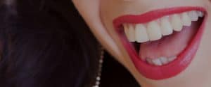 Un sorriso da VIP
