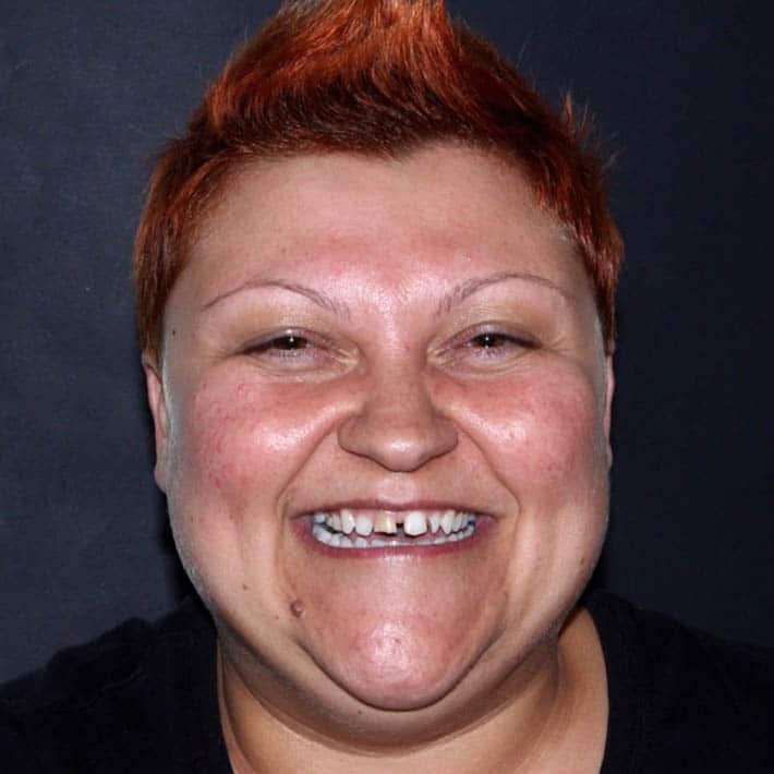 Prima